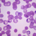 A Mutation Is Making It Easier for Drug-Resistant Malaria to Spread